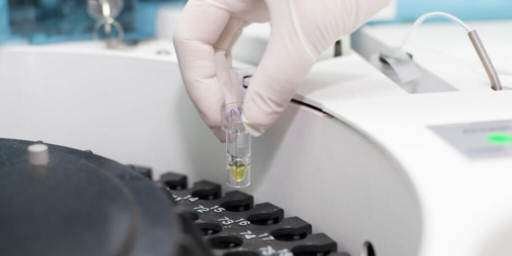 Rise of Antibiotic Resistant Super Bugs