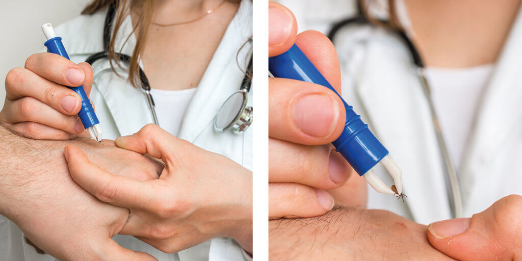 Make Your Own Tick Kit